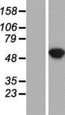 Western Blot: Argininosuccinate Lyase Overexpression Lysate (Adult Normal) [NBP2-11036] Left-Empty vector transfected control cell lysate (HEK293 cell lysate); Right -Over-expression Lysate for Argininosuccinate Lyase.