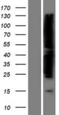 Western Blot: FAK Overexpression Lysate (Adult Normal) [NBP2-11311] Left-Empty vector transfected control cell lysate (HEK293 cell lysate); Right -Over-expression Lysate for FAK.