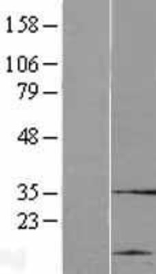 Western Blot: cysteine/histidine-rich 1 Overexpression Lysate (Adult Normal) [NBP2-11109] Left-Empty vector transfected control cell lysate (HEK293 cell lysate); Right -Over-expression Lysate for cysteine/histidine-rich 1.
