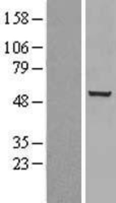 Western Blot: Chk1 Overexpression Lysate (Adult Normal) [NBP2-11409] Left-Empty vector transfected control cell lysate (HEK293 cell lysate); Right -Over-expression Lysate for Chk1.