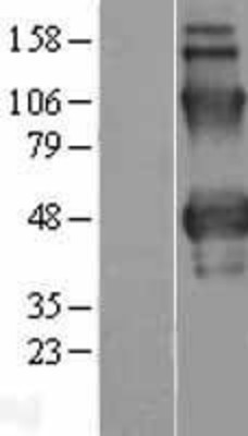 Western Blot: Properdin Overexpression Lysate (Adult Normal) [NBP2-11352] Left-Empty vector transfected control cell lysate (HEK293 cell lysate); Right -Over-expression Lysate for Properdin.