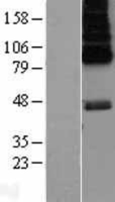 Western Blot: 5HT6 Receptor Overexpression Lysate (Adult Normal) [NBL1-11782] Left-Empty vector transfected control cell lysate (HEK293 cell lysate); Right -Over-expression Lysate for 5HT6 Receptor.