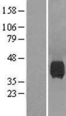 Western Blot: Neuraminidase Overexpression Lysate (Adult Normal) [NBL1-13594] Left-Empty vector transfected control cell lysate (HEK293 cell lysate); Right -Over-expression Lysate for Neuraminidase.