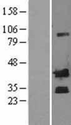 Western Blot: Corticotropin Releasing Factor Overexpression Lysate (Adult Normal) [NBL1-09475] Left-Empty vector transfected control cell lysate (HEK293 cell lysate); Right -Over-expression Lysate for Corticotropin Releasing Factor.