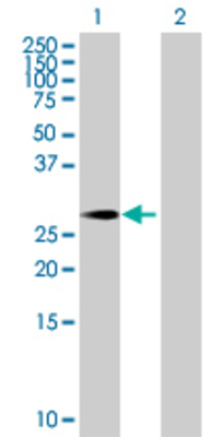 Lane 1: PRRX1 transfected lysate (23.98 KDa) Lane 2: Non-transfected lysate.