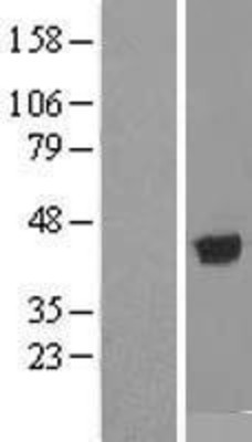 Western Blot: alcohol dehydrogenase 1B Overexpression Lysate (Adult Normal) [NBL1-07335] Left-Empty vector transfected control cell lysate (HEK293 cell lysate); Right -Over-expression Lysate for alcohol dehydrogenase 1B.