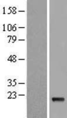 Western Blot: IFNA5 Overexpression Lysate (Adult Normal) [NBL1-11844] Left-Empty vector transfected control cell lysate (HEK293 cell lysate); Right -Over-expression Lysate for IFNA5.