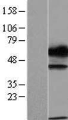 Western Blot: TXNDC15 Overexpression Lysate (Adult Normal) [NBL1-17468] Left-Empty vector transfected control cell lysate (HEK293 cell lysate); Right -Over-expression Lysate for TXNDC15.