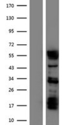 Western Blot: Staufen Overexpression Lysate (Adult Normal) [NBP2-11200] Left-Empty vector transfected control cell lysate (HEK293 cell lysate); Right -Over-expression Lysate for Staufen.