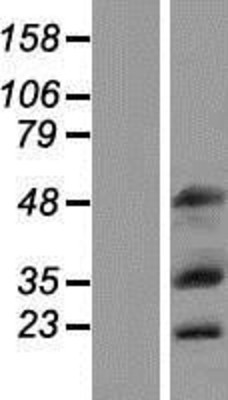 Western Blot: MOX1 Overexpression Lysate (Adult Normal) [NBP2-11202] Left-Empty vector transfected control cell lysate (HEK293 cell lysate); Right -Over-expression Lysate for MOX1.