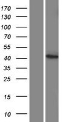 Western Blot: CYP27C1 Overexpression Lysate (Adult Normal) [NBP2-08955] Left-Empty vector transfected control cell lysate (HEK293 cell lysate); Right -Over-expression Lysate for CYP27C1.