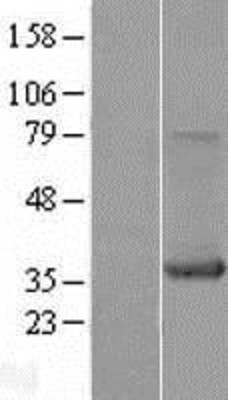 Western Blot: Bcl 7A Overexpression Lysate (Adult Normal) [NBP2-11042] Left-Empty vector transfected control cell lysate (HEK293 cell lysate); Right -Over-expression Lysate for Bcl 7A.