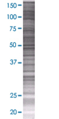 THEM4 transfected lysate.