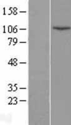 Western Blot: DNA Ligase IV Overexpression Lysate (Adult Normal) [NBP2-11429] Left-Empty vector transfected control cell lysate (HEK293 cell lysate); Right -Over-expression Lysate for DNA Ligase IV.