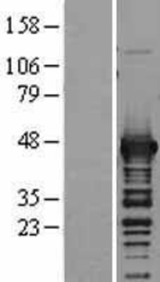 Western Blot: Aspartate Aminotransferase Overexpression Lysate (Adult Normal) [NBL1-11207] Left-Empty vector transfected control cell lysate (HEK293 cell lysate); Right -Over-expression Lysate for Aspartate Aminotransferase.