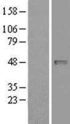 Western Blot: NAPE-PLD Overexpression Lysate (Adult Normal) [NBP2-11390] Left-Empty vector transfected control cell lysate (HEK293 cell lysate); Right -Over-expression Lysate for NAPE-PLD.