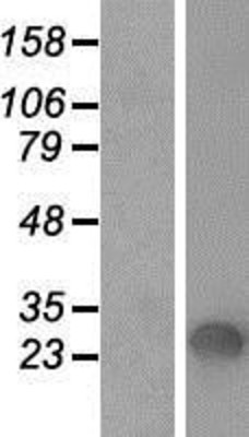 Western Blot: Surfactant Protein A Overexpression Lysate (Adult Normal) [NBP2-11485] Left-Empty vector transfected control cell lysate (HEK293 cell lysate); Right -Over-expression Lysate for Surfactant Protein A.