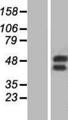 Western Blot: GM-CSF Receptor alpha Overexpression Lysate (Adult Normal) [NBP2-11303] Left-Empty vector transfected control cell lysate (HEK293 cell lysate); Right -Over-expression Lysate for GM-CSF Receptor alpha.