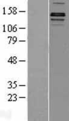 Western Blot: JMJD1A Overexpression Lysate (Adult Normal) [NBP2-11469] Left-Empty vector transfected control cell lysate (HEK293 cell lysate); Right -Over-expression Lysate for JMJD1A.