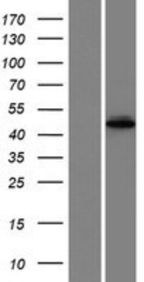 Western Blot: METT5D1 Overexpression Lysate (Adult Normal) [NBP2-11413] Left-Empty vector transfected control cell lysate (HEK293 cell lysate); Right -Over-expression Lysate for METT5D1.