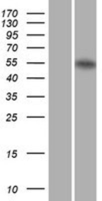 Western Blot: Retinoic Acid Receptor alpha Overexpression Lysate (Adult Normal) [NBP2-11345] Left-Empty vector transfected control cell lysate (HEK293 cell lysate); Right -Over-expression Lysate for Retinoic Acid Receptor alpha.