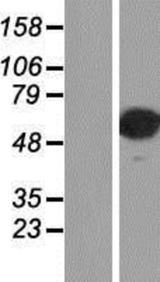 Western Blot: AP2 alpha Overexpression Lysate (Adult Normal) [NBP2-11607] Left-Empty vector transfected control cell lysate (HEK293 cell lysate); Right -Over-expression Lysate for AP2 alpha.