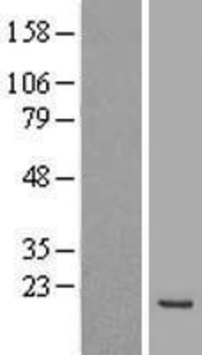 Western Blot: MAX Overexpression Lysate (Adult Normal) [NBL1-12921] Left-Empty vector transfected control cell lysate (HEK293 cell lysate); Right -Over-expression Lysate for MAX.