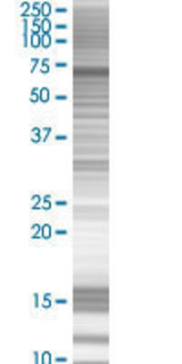GTPBP2 transfected lysate.