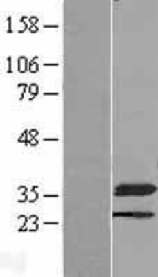 Western Blot: NMRAL1 Overexpression Lysate (Adult Normal) [NBL1-13693] Left-Empty vector transfected control cell lysate (HEK293 cell lysate); Right -Over-expression Lysate for NMRAL1.