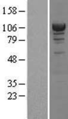 Western Blot: Alpha Actinin 4 Overexpression Lysate (Adult Normal) [NBL1-07283] Left-Empty vector transfected control cell lysate (HEK293 cell lysate); Right -Over-expression Lysate for Alpha Actinin 4.
