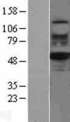 Western Blot: RUVBL2 Overexpression Lysate (Adult Normal) [NBL1-15632] Left-Empty vector transfected control cell lysate (HEK293 cell lysate); Right -Over-expression Lysate for RUVBL2.
