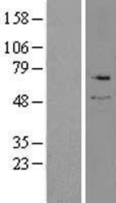 Western Blot: Serine Palmitoyltransferase 2 Overexpression Lysate (Adult Normal) [NBL1-16441] Left-Empty vector transfected control cell lysate (HEK293 cell lysate); Right -Over-expression Lysate for Serine Palmitoyltransferase 2.
