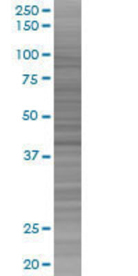 ACTL7B transfected lysate.