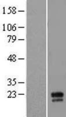 Western Blot: MD2 Overexpression Lysate (Adult Normal) [NBL1-12751] Left-Empty vector transfected control cell lysate (HEK293 cell lysate); Right -Over-expression Lysate for MD2.