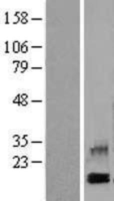 Western Blot: PF4/Platelet factor 4 Overexpression Lysate (Adult Normal) [NBL1-14305] Left-Empty vector transfected control cell lysate (HEK293 cell lysate); Right -Over-expression Lysate for PF4/Platelet factor 4.