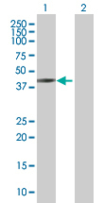 Lane 1: ACTL7B transfected lysate (45.2 KDa) Lane 2: Non-transfected lysate.