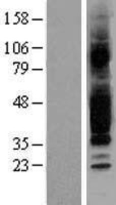 Western Blot: GPR40 Overexpression Lysate (Adult Normal) [NBL1-10681] Left-Empty vector transfected control cell lysate (HEK293 cell lysate); Right -Over-expression Lysate for GPR40.