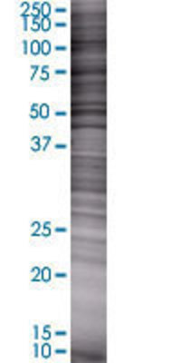 JAM2 transfected lysate.