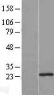 Western Blot: DHFRL1 Overexpression Lysate (Adult Normal) [NBL1-09861] Left-Empty vector transfected control cell lysate (HEK293 cell lysate); Right -Over-expression Lysate for DHFRL1.