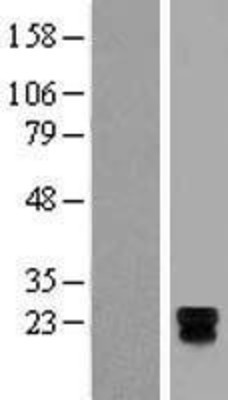 Western Blot: TSPAN18 Overexpression Lysate (Adult Normal) [NBL1-17371] Left-Empty vector transfected control cell lysate (HEK293 cell lysate); Right -Over-expression Lysate for TSPAN18.