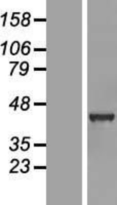 Western Blot: GABPB1 Overexpression Lysate (Adult Normal) [NBL1-10913] Left-Empty vector transfected control cell lysate (HEK293 cell lysate); Right -Over-expression Lysate for GABPB1.