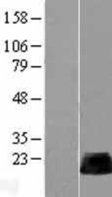Western Blot: RhoB Overexpression Lysate (Adult Normal) [NBL1-15350] Left-Empty vector transfected control cell lysate (HEK293 cell lysate); Right -Over-expression Lysate for RhoB.