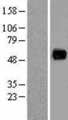 Western Blot: PAG Overexpression Lysate (Adult Normal) [NBL1-14068] Left-Empty vector transfected control cell lysate (HEK293 cell lysate); Right -Over-expression Lysate for PAG.