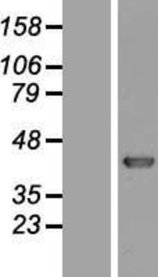 Western Blot: KHDRBS3 Overexpression Lysate (Adult Normal) [NBL1-12231] Left-Empty vector transfected control cell lysate (HEK293 cell lysate); Right -Over-expression Lysate for KHDRBS3.