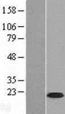 Western Blot: Calcium Channel Flower Homolog Overexpression Lysate (Adult Normal) [NBL1-08599] Left-Empty vector transfected control cell lysate (HEK293 cell lysate); Right -Over-expression Lysate for Calcium Channel Flower Homolog.
