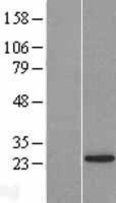 Western Blot: LSM12 Overexpression Lysate (Adult Normal) [NBL1-12723] Left-Empty vector transfected control cell lysate (HEK293 cell lysate); Right -Over-expression Lysate for LSM12.