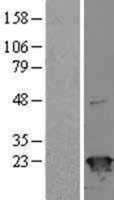 Western Blot: SR1 Overexpression Lysate (Adult Normal) [NBL1-16451] Left-Empty vector transfected control cell lysate (HEK293 cell lysate); Right -Over-expression Lysate for SR1.