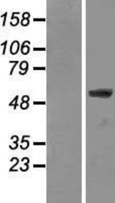 Western Blot: Lamin A Overexpression Lysate (Adult Normal) [NBL1-12565] Left-Empty vector transfected control cell lysate (HEK293 cell lysate); Right -Over-expression Lysate for Lamin A.