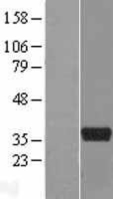 Western Blot: ART5 Overexpression Lysate (Adult Normal) [NBL1-07745] Left-Empty vector transfected control cell lysate (HEK293 cell lysate); Right -Over-expression Lysate for ART5.