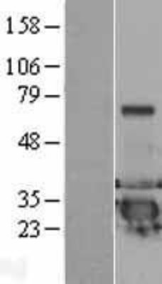 Western Blot: DCXR Overexpression Lysate (Adult Normal) [NBL1-09762] Left-Empty vector transfected control cell lysate (HEK293 cell lysate); Right -Over-expression Lysate for DCXR.
